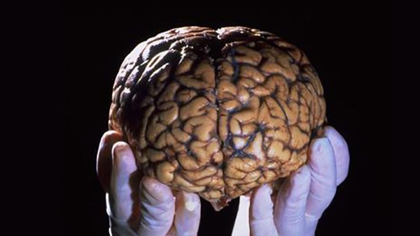 Khi giải quyết 1 bài toán, não bộ của bạn trông như thế này! - Ảnh 1.