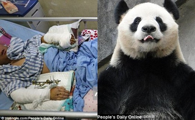 Trung Quốc: Bảo mẫu bị gấu trúc đánh trọng thương, phải nhập viện trong tình trạng nguy kịch - Ảnh 3.