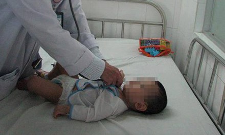 H&atilde;i h&ugrave;ng ph&aacute;t hiện tụ điện trong phế quản b&eacute; 8 th&aacute;ng tuổi - Ảnh 1.