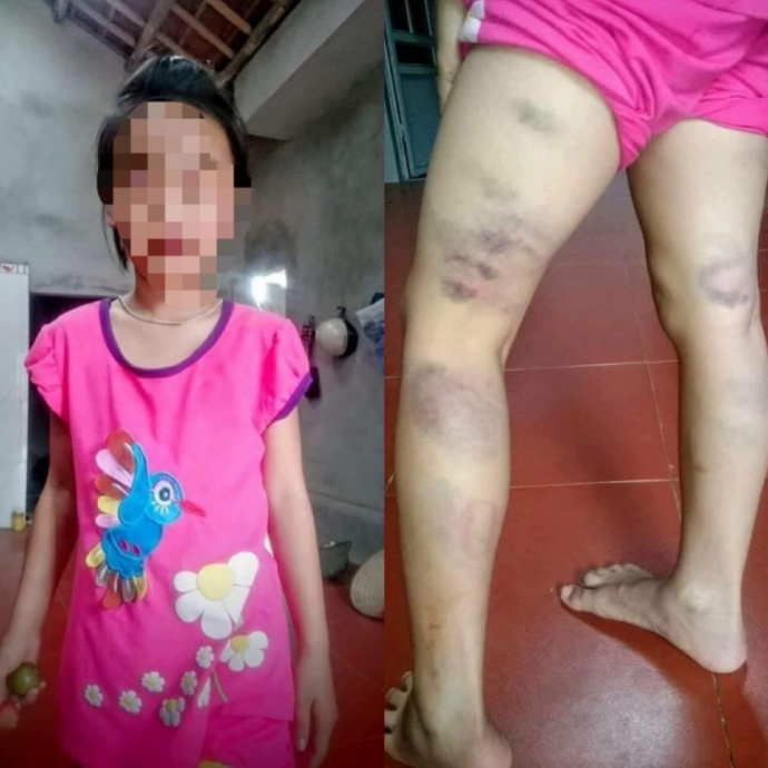Phẫn nộ cô giáo bạo hành học sinh vì... viết sai chính tả - Ảnh 1.