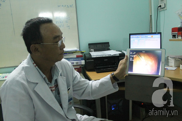 TP.HCM: Một phụ nữ đi trồng răng rồi nuốt luôn mũi khoan vào bụng - Ảnh 1.