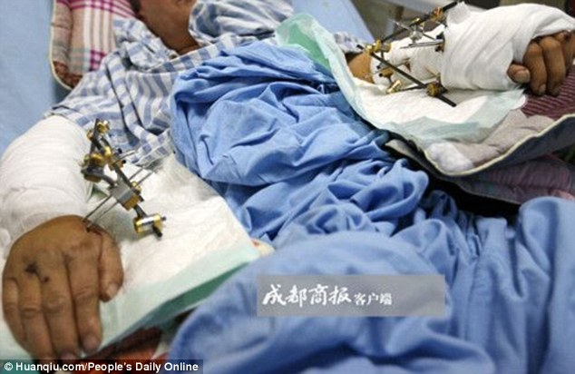 Trung Quốc: Bảo mẫu bị gấu trúc đánh trọng thương, phải nhập viện trong tình trạng nguy kịch - Ảnh 1.