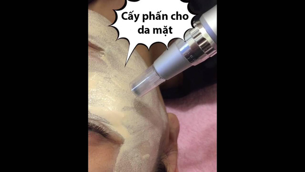 Cấy phấn - CC Cover chỉ là cách gọi... cho vui & loạt giải đáp về 2 cách làm gây tranh cãi - Ảnh 3. Cấy phấn - CC Cover chỉ là cách gọi... cho vui & loạt giải đáp về 2 cách làm gây tranh cãi - Ảnh 3.
