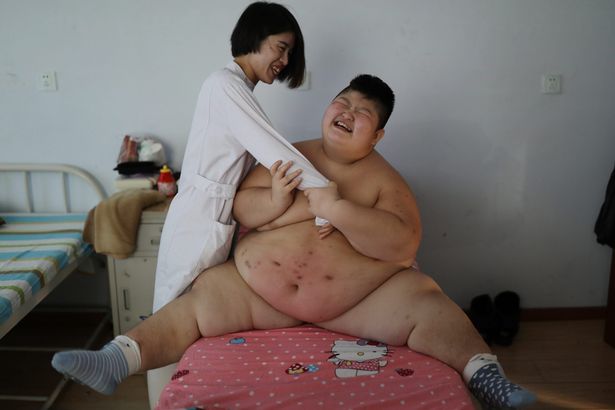 Dùng lửa đốt mỡ bụng, phương pháp giảm cân cho nhiều trẻ em béo phì tại Trung Quốc - Ảnh 5.