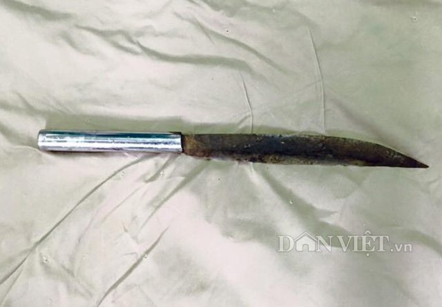 Quảng Ninh: Thai phụ bị dao nhọn đ&acirc;m v&agrave;o n&atilde;o s&acirc;u 4cm - Ảnh 3.