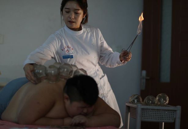 Dùng lửa đốt mỡ bụng, phương pháp giảm cân cho nhiều trẻ em béo phì tại Trung Quốc - Ảnh 3.