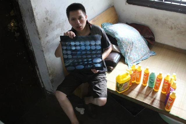 Mồ c&ocirc;i người y&ecirc;u v&igrave; sở th&iacute;ch uống nước tẩy rửa như rượu bia - Ảnh 5.