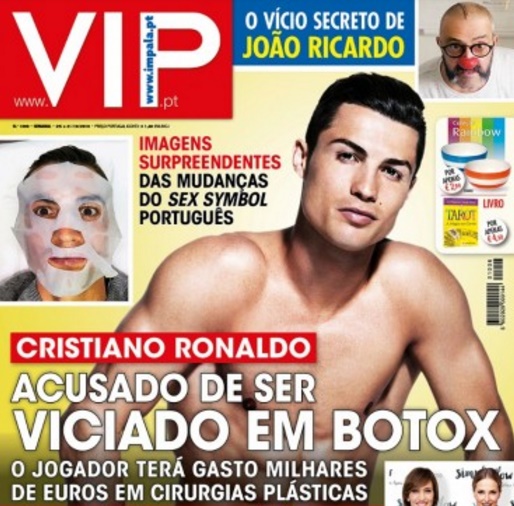 Ronaldo ngày càng đẹp trai nhờ phẫu thuật thẩm mỹ - Ảnh 4.