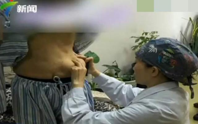 V&agrave;i năm sau khi n&acirc;ng ngực, chất keo độn ngực của người phụ nữ Trung Quốc bỗng... tr&ocirc;i xuống bụng - Ảnh 1.