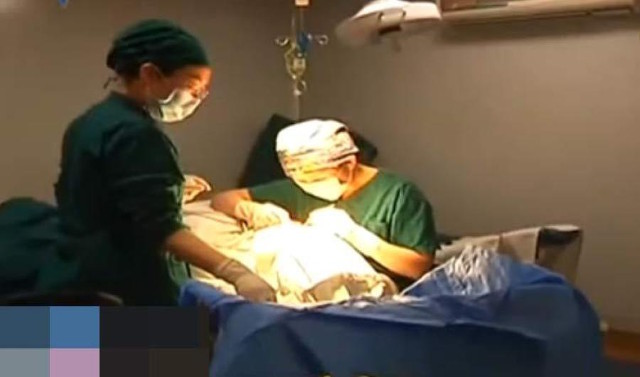 V&agrave;i năm sau khi n&acirc;ng ngực, chất keo độn ngực của người phụ nữ Trung Quốc bỗng... tr&ocirc;i xuống bụng - Ảnh 3.