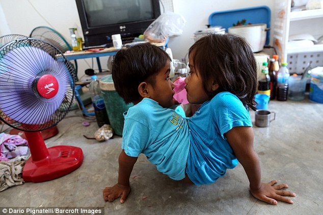 Cuộc sống của cặp chị em song sinh d&iacute;nh liền th&acirc;n - Ảnh 2.