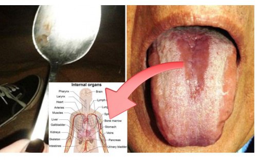 Cách phát hiện nội tạng có đang bị nhiễm độc hay không chỉ bằng 1 chiếc thìa - Ảnh 1.