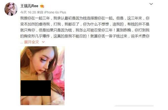 Mẫu nữ Trung Quốc tố bạn trai đánh đập, bạo hành suốt 3 năm gây chấn động showbiz - Ảnh 2.