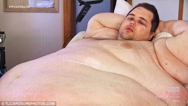 Người đàn ông béo tới nỗi lở loét da vì chỉ nằm ì một chỗ suốt 3 năm - Ảnh 1.