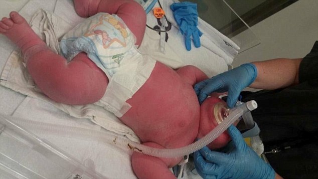 Bé trai vừa chào đời đã nặng mức kỷ lục 7,4kg - Ảnh 1.