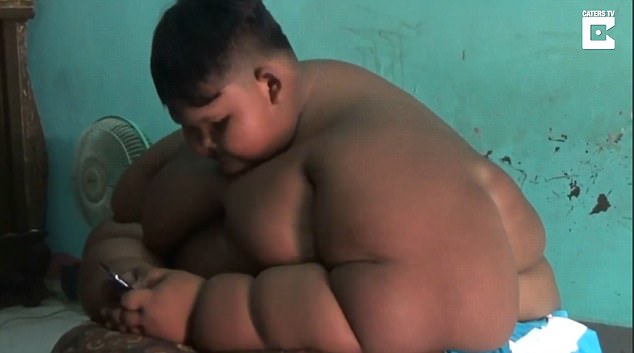 Nghiện mỳ ăn liền và Coca, bé trai mới 10 tuổi đã nặng 190kg - Ảnh 2.