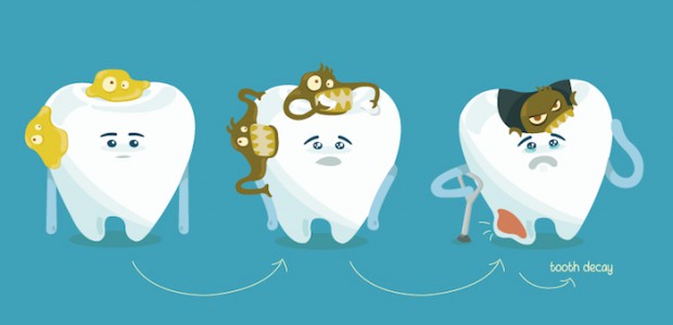 4 thói quen nhiều người mắc phải khiến răng ngày càng hỏng nặng - Ảnh 1.