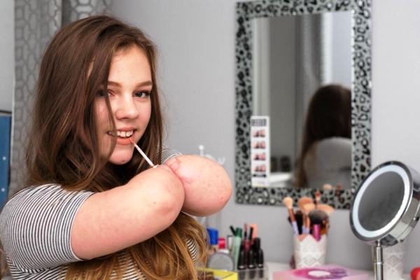 Vượt qua mặc cảm bản thân, cô gái cụt tứ chi trở thành beauty blogger đình đám trên Youtube - Ảnh 2.