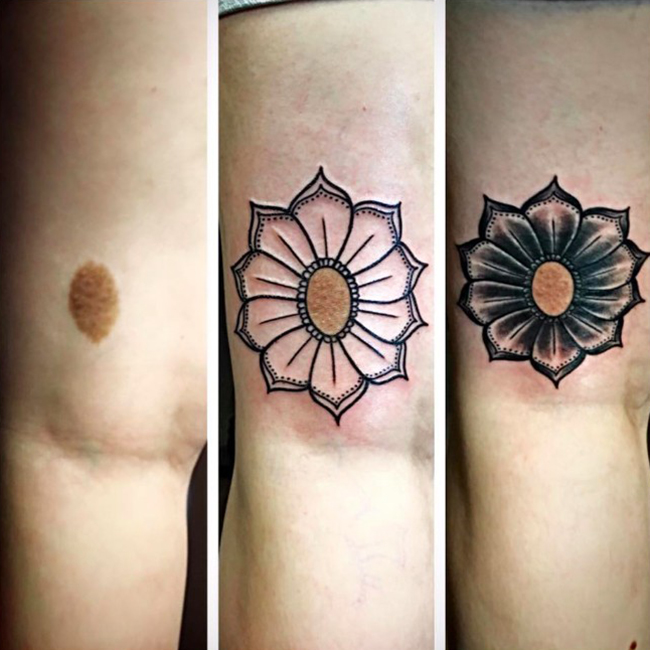 Hình xăm che sẹo ở đầu gối - Tattoo Gà