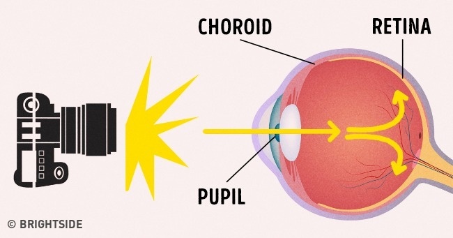 Ai cũng từng thắc mắc chụp ảnh ban đêm hay bị mắt đỏ, đây là lí do tại sao - Ảnh 2.