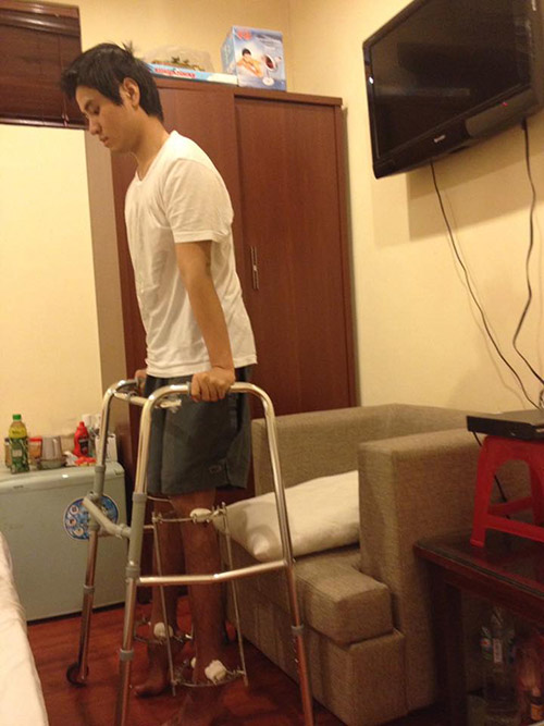Con trai Việt v&agrave; 3 ca phẫu thuật thẩm mỹ chỉ nghe th&ocirc;i l&agrave; đ&atilde; sợ muốn ngất! - Ảnh 2.