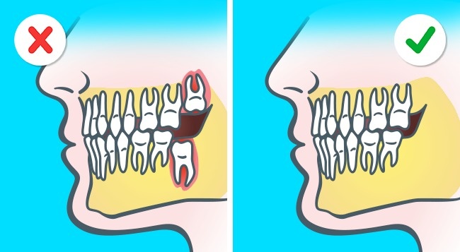 7 bằng chứng rõ như ban ngày cho thấy con người vẫn đang tiến hóa từng ngày - Ảnh 1.