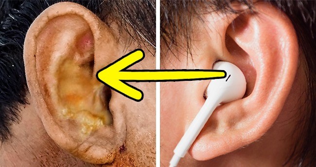 D&ugrave; th&acirc;n thiết đến đ&acirc;u đi chăng nữa th&igrave; bạn cũng tuyệt đối kh&ocirc;ng n&ecirc;n x&agrave;i chung những đồ vật n&agrave;y - Ảnh 6.