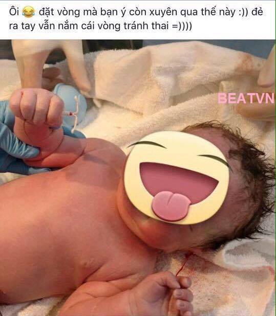 Khoảnh khắc kỳ diệu: Em bé sinh ra vẫn nắm chặt chiếc vòng tránh thai - Ảnh 1.