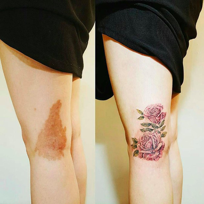 Cover tattoo, rose tattoo,hình xăm hoa hồng, đè hình xăm, sửa hình xăm  cũ,che hình xăm,sửa hình xăm hỏng, hình xăm đẹp,… | Hình xăm, Mini tattoos, Hình  xăm hoa hồng