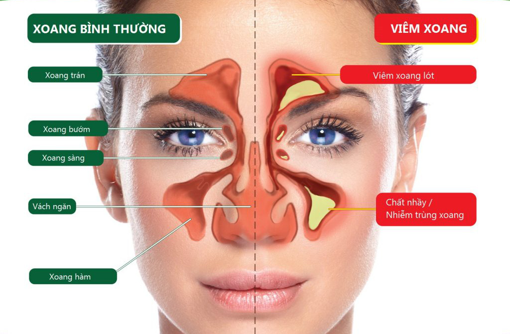 4. Phương pháp điều trị và phòng ngừa