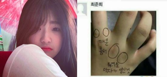 Sau bức thư thứ 2 tố bà ngoại bạo hành, con gái Choi Jin Sil đột ngột nhập viện - Ảnh 2.