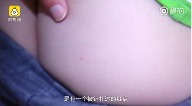 9 b&eacute; mầm non bị c&ocirc; gi&aacute;o đ&acirc;m kim ti&ecirc;m v&agrave;o người do kh&ocirc;ng nghe lời - Ảnh 3.