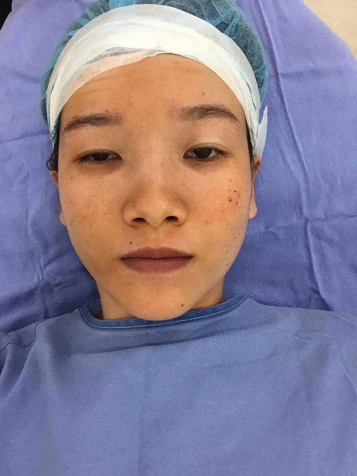 Màn lột xác bất ngờ của nữ sinh ĐH Y khoa Vinh từng bị nhà người yêu từ chối vì có đôi mắt lươn - Ảnh 4. Màn lột xác bất ngờ của nữ sinh ĐH Y khoa Vinh từng bị nhà người yêu từ chối vì có đôi mắt lươn - Ảnh 4.