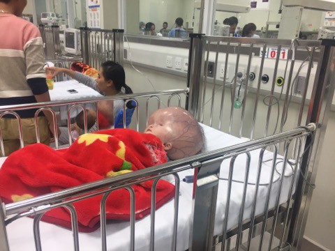 Sau thời gian chống chọi với bệnh tật, b&eacute; trai bị n&atilde;o &uacute;ng thủy ở Thanh H&oacute;a đ&atilde; qua đời - Ảnh 1.