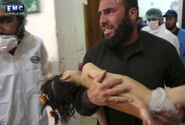 Hình ảnh đau lòng về những đứa trẻ là nạn nhân trong cuộc chiến hóa học tại Syria - Ảnh 4.