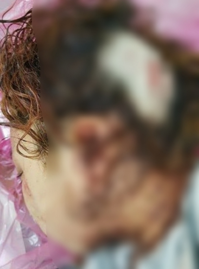 Hàn Quốc: Bị đàn chị quây đánh hội đồng, nữ sinh 14 tuổi toàn thân đầy máu, mặt mũi biến dạng phải quỳ gối hối lỗi - Ảnh 4.