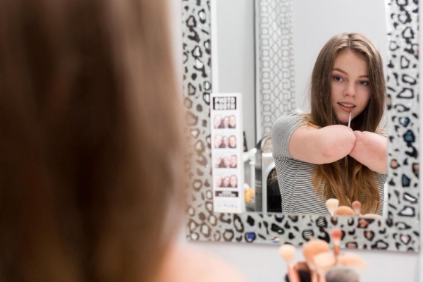 Vượt qua mặc cảm bản thân, cô gái cụt tứ chi trở thành beauty blogger đình đám trên Youtube - Ảnh 4.