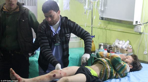 Hình ảnh đau lòng về những đứa trẻ là nạn nhân trong cuộc chiến hóa học tại Syria - Ảnh 5.