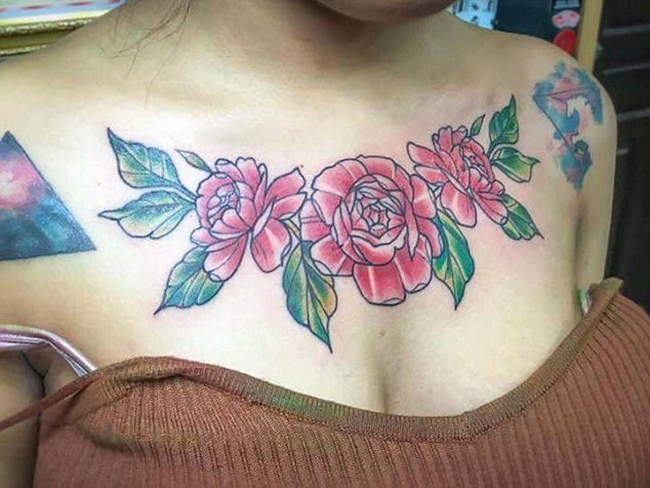 Xóa hình xăm hoa hồng khủng trên ngực, nữ sinh viên Thái Lan phải nhận cái kết đau đớn - Ảnh 2.