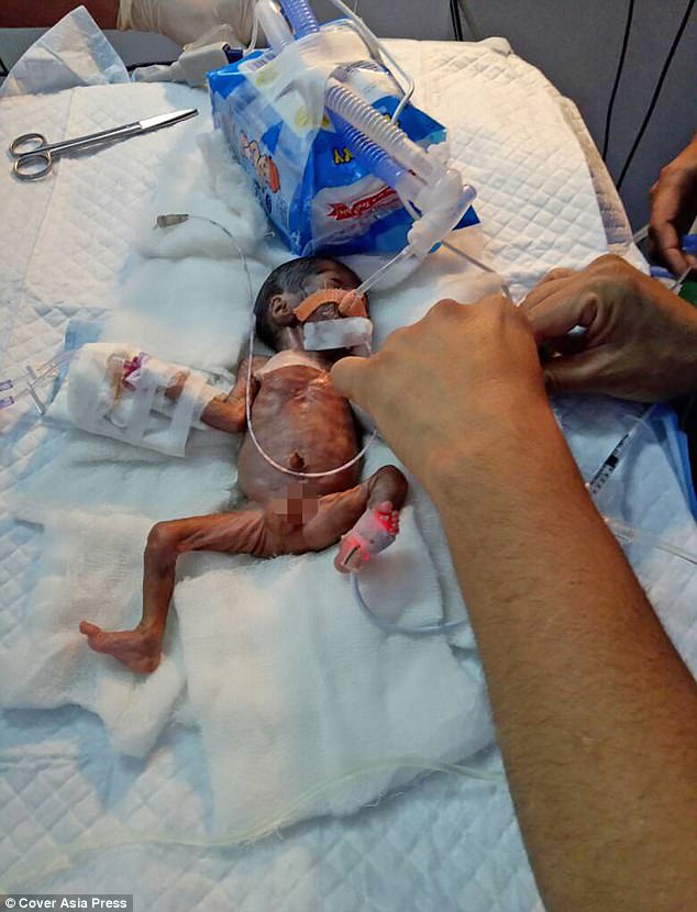 Em bé hạt tiêu chỉ nhỏ bằng bàn tay nặng chưa tới 0,5kg - Ảnh 3.
