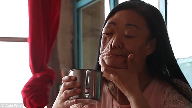 Cuộc đời người phụ nữ mặt voi đã thay đổi hoàn toàn nhờ sử dụng mạng xã hội - Ảnh 2.