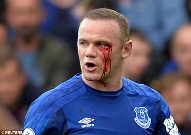 Rooney rách mắt, máu chảy thành dòng trên khuôn mặt - Ảnh 1.