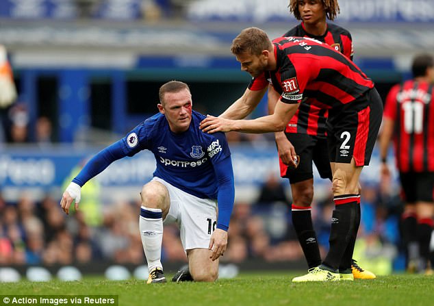 Rooney rách mắt, máu chảy thành dòng trên khuôn mặt - Ảnh 4.