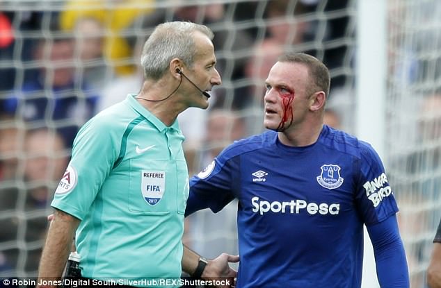 Rooney rách mắt, máu chảy thành dòng trên khuôn mặt - Ảnh 5.