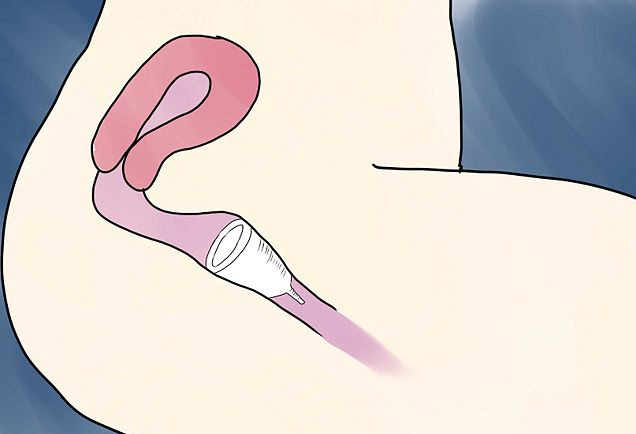 Trải nghiệm lần đầu dùng cốc nguyệt san: Từ thất bại nhớ đời đến cảm giác trên cả tuyệt vời - Ảnh 2.