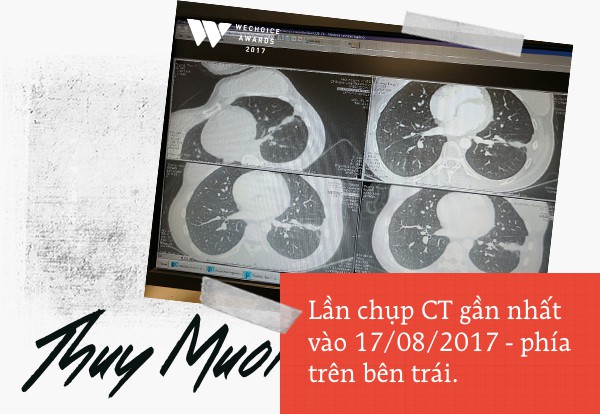 Nữ hoàng startup Thủy Muối: bước vào trận chiến cận tử từ con số 0 và tái sinh sau một năm chiến đấu với ung thư - Ảnh 10.