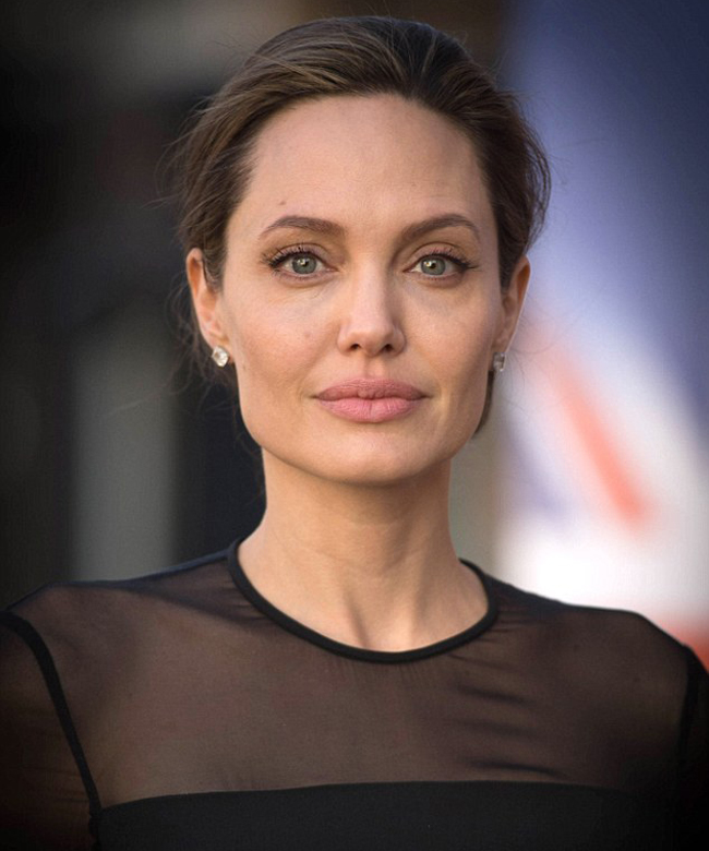 Hội chứng liệt nửa cơ mặt mà Angelina Jolie mắc phải có thể xảy ra ở người trẻ - Ảnh 1.