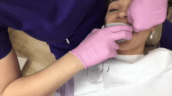Xem chuyên gia bật mí quy trình hô biến răng vàng ố thành răng trắng - Ảnh 7.