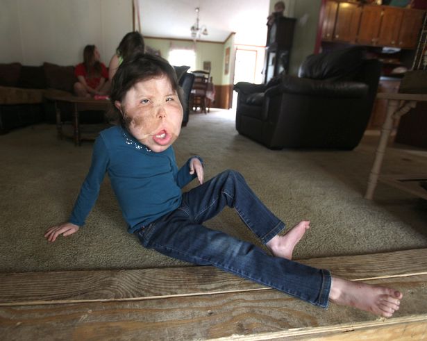 Bé gái 9 tuổi mắc chứng bệnh lạ lùng không tên trải qua vô số cuộc phẫu thuật - Ảnh 8.