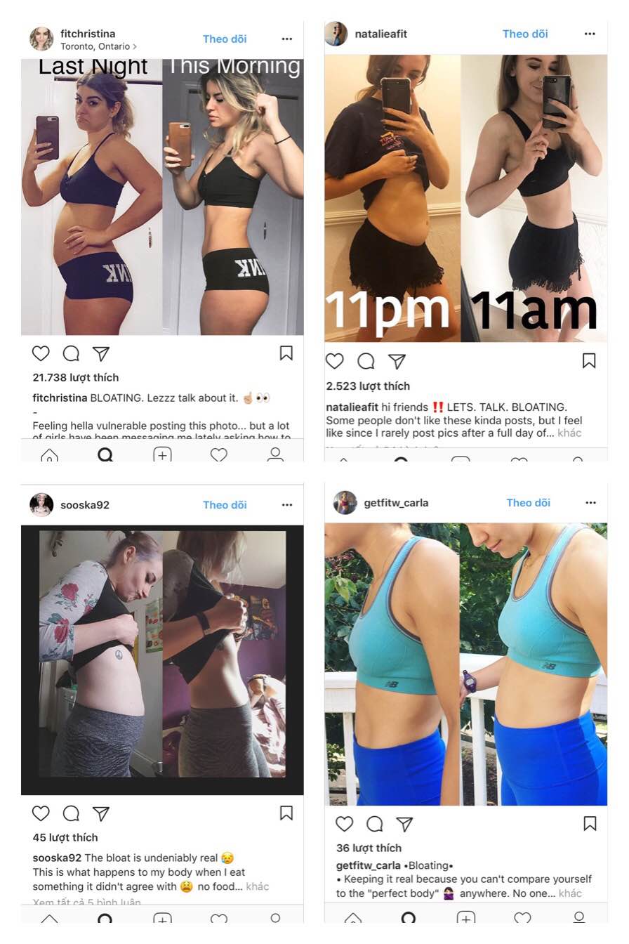 Những nguy&ecirc;n nh&acirc;n &ldquo;giật m&igrave;nh&rdquo; khiến bụng to m&agrave; kh&ocirc;ng phải do mỡ - Ảnh 1.